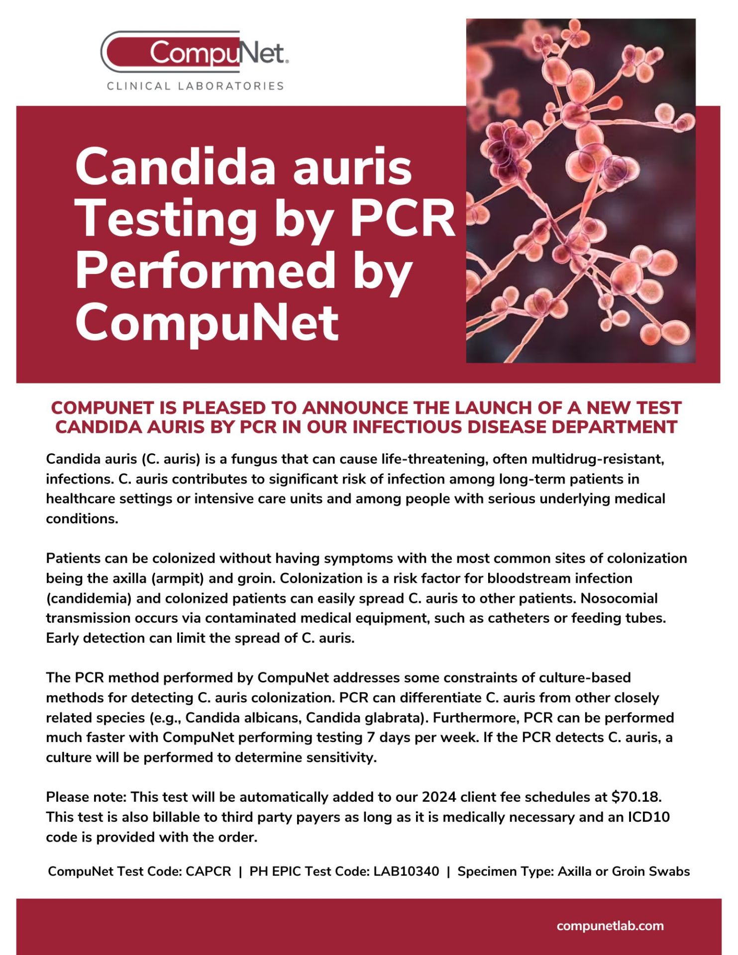 Candida Auris Testing By Pcr Performed By Compunet Compunet Clinical